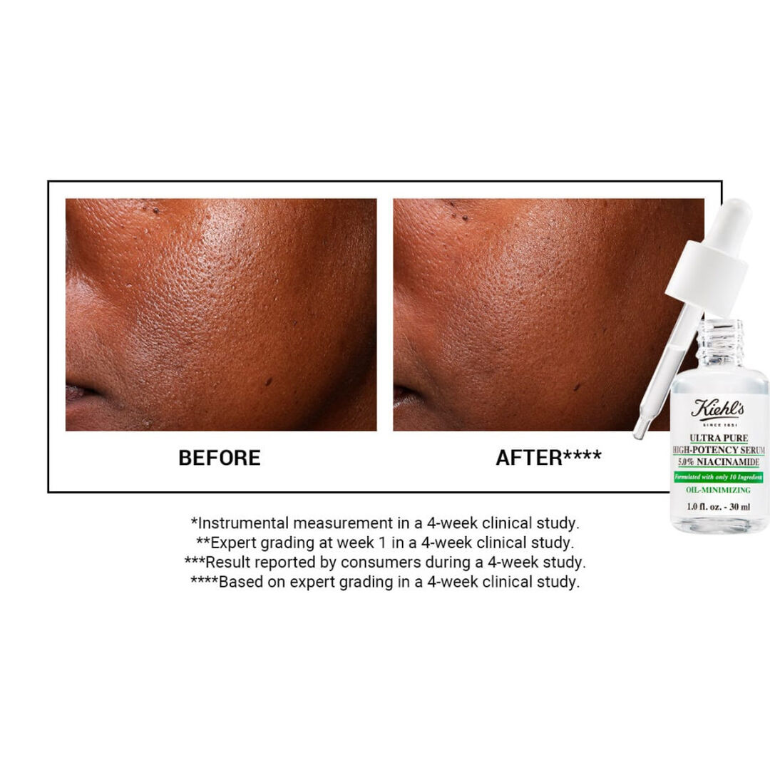 Ultra Pure High-Potency Serum 5.0% Niacinamide - KIEHL'S - Pure Serums - Imagem 4