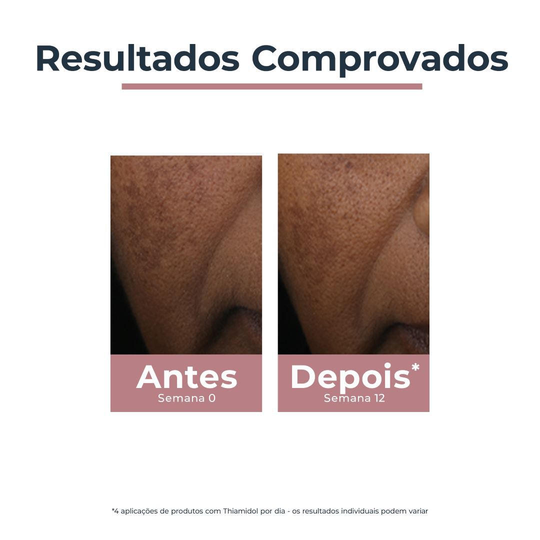 Anti-Pigment Corretor Localizado de Manchas - EUCERIN -  - Imagem 3