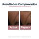 Anti-Pigment Corretor Localizado de Manchas - EUCERIN -  - Imagem 3