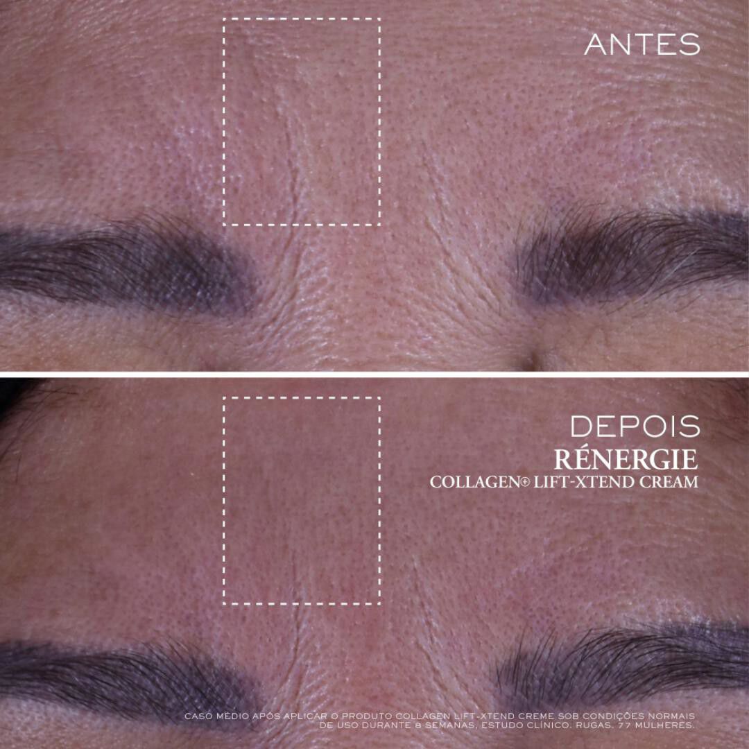 Collagen+ Lift-Xtend Creme - Lanc&ocirc;me - R&eacute;nergie - Imagem 4