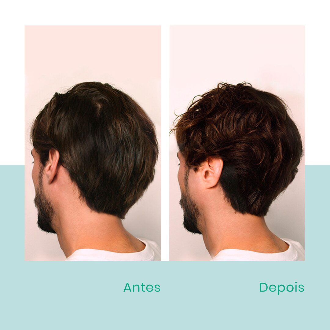 Forticea Champô Energizante - RENE FURTERER -  - Imagem 2