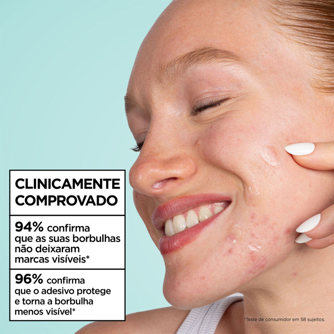 Pimple Patch Ultra Power Pure Active Anti-Imperfei&ccedil;&otilde;es. - GARNIER -  - Imagem 5