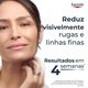 Hyaluron-Filler x3 Effect Creme de Dia - Pele Normal a Mista FPS 15 - EUCERIN -  - Imagem 8