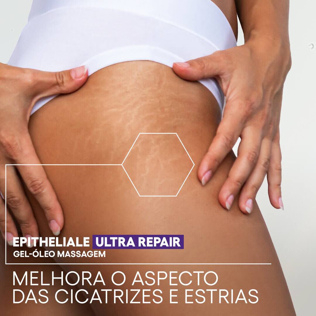Epitheliale MASSAGE - Gel-&oacute;leo de Massagem - A-DERMA -  - Imagem 2