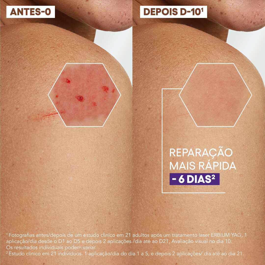 Epitheliale Ultra Repair - Creme Reparador - A-DERMA -  - Imagem 5