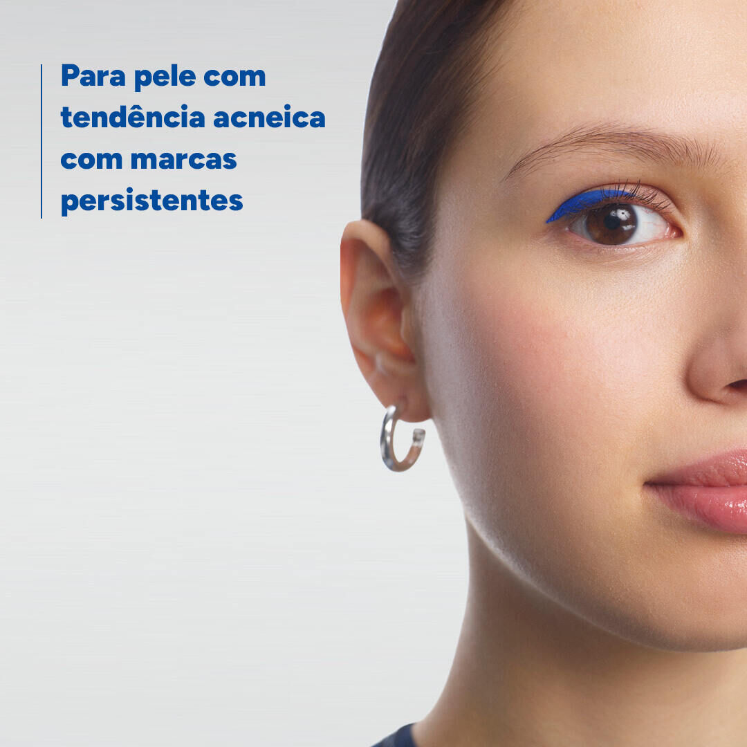 Ducray Keracnyl PP+ Creme Anti Imperfei&ccedil;&otilde;es 30ml - DUCRAY -  - Imagem 2