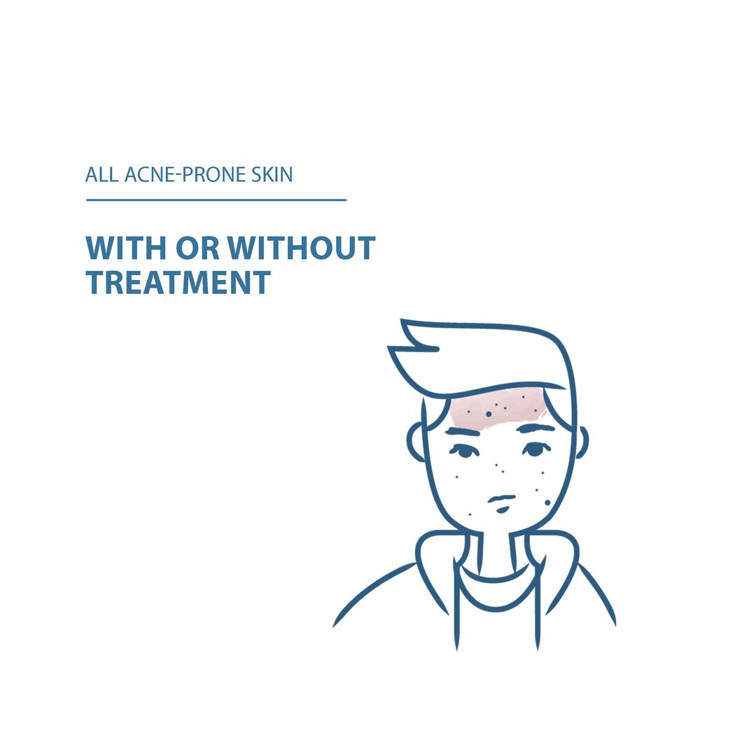 Ducray Keracnyl Gel Espuma - DUCRAY -  - Imagem 4