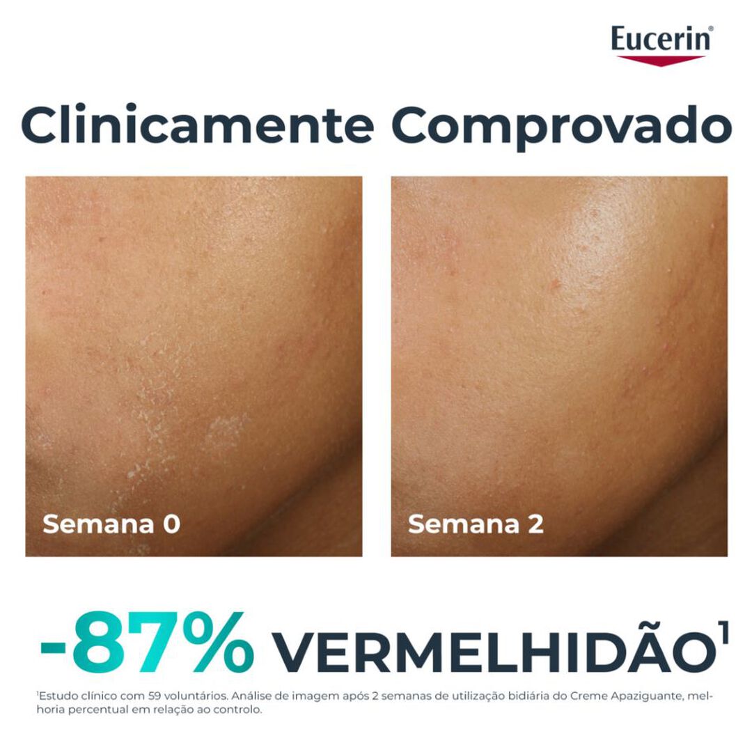 DermoPure Creme Apaziguante - EUCERIN -  - Imagem 4