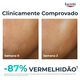 DermoPure Creme Apaziguante - EUCERIN -  - Imagem 4
