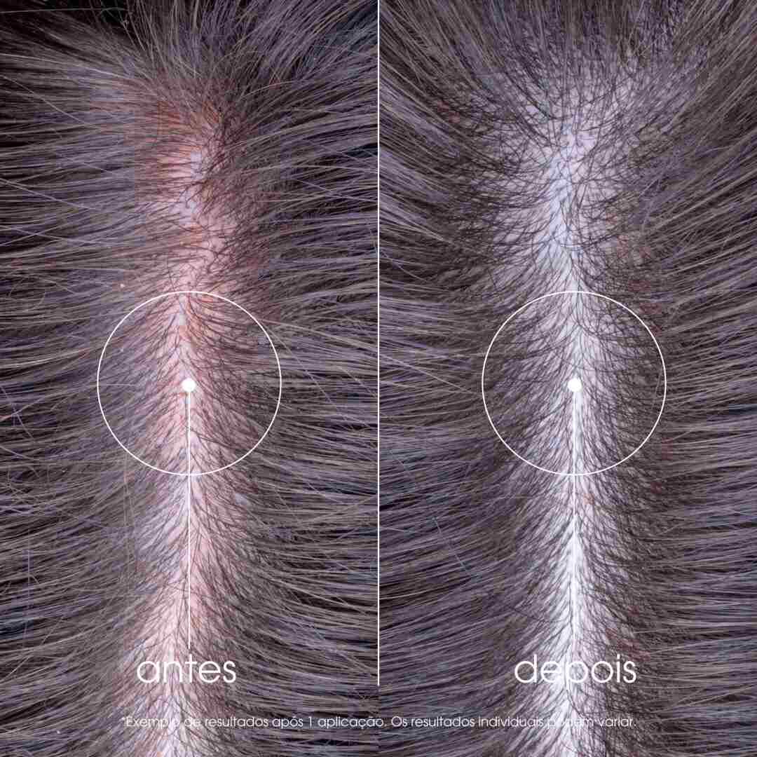 Champ&ocirc; Pe&oacute;nia - KLORANE -  - Imagem 5