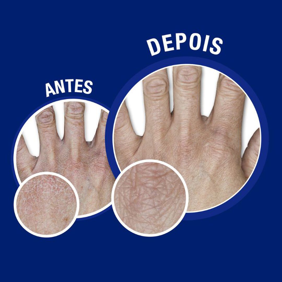 Creme M&atilde;os e Unhas - NEUTROGENA -  - Imagem 4