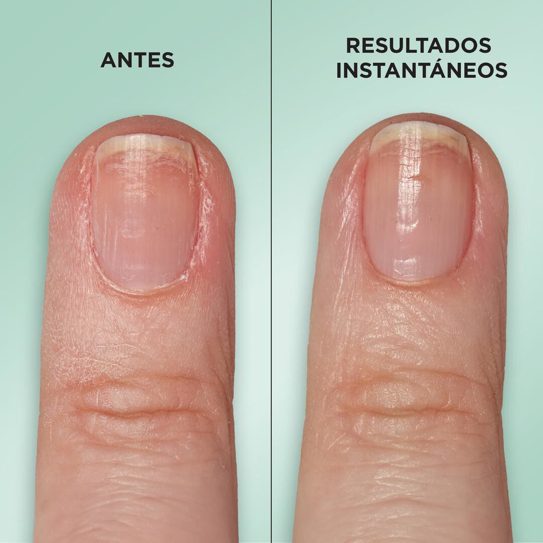 Gel Rehab Nail Repair Seum - SALLY HANSEN -  - Imagem 6