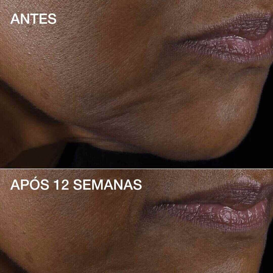 Clinique Smart Clinical RepairTM Lifting Face + Neck Cream - CLINIQUE - Smart - Imagem 14