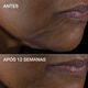 Clinique Smart Clinical RepairTM Lifting Face + Neck Cream - CLINIQUE - Smart - Imagem 14