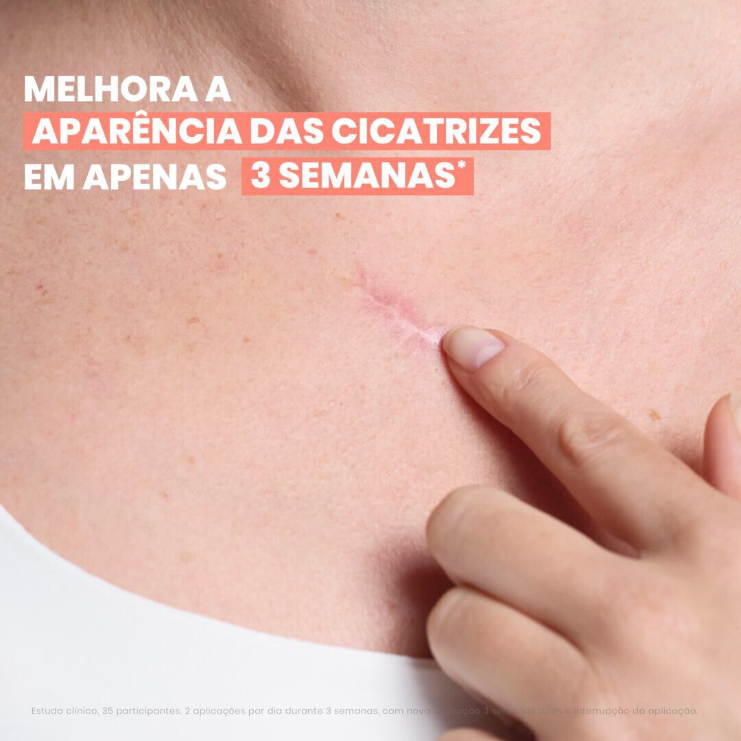 Cicalfate+ Gel Massagem Cicatrizes - AVENE -  - Imagem 5