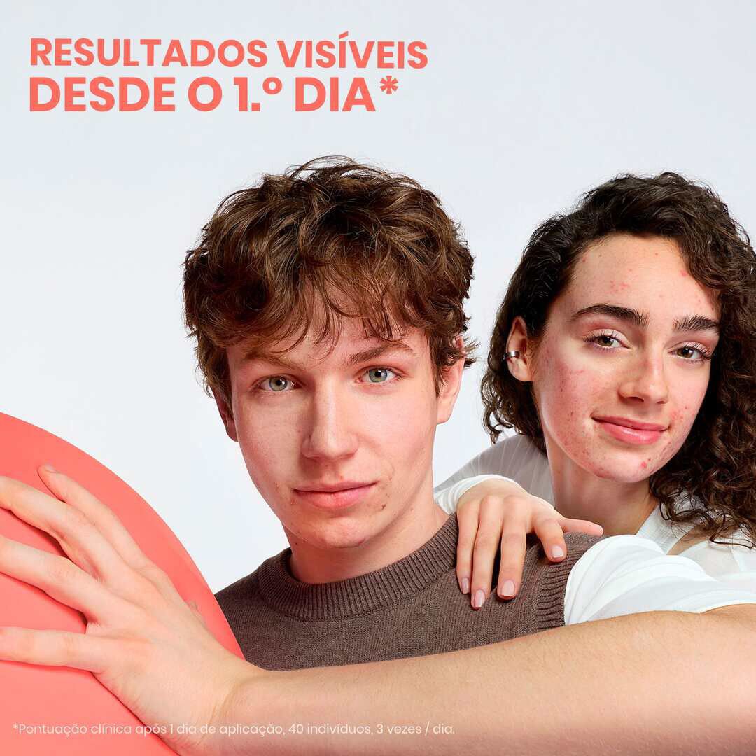 Cleanance Comedomed Peeling Cuidado Localizado - AVENE -  - Imagem 6