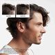 Kit Tratamento Cabelo Natural - Nioxin - Sistema 2 - Imagem 8