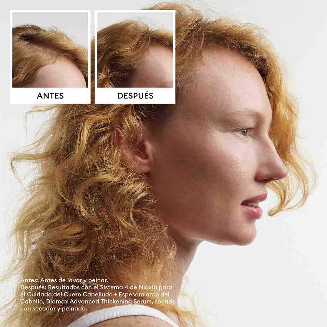 Champ&ocirc; - Nioxin - Sistema 4 - Imagem 5