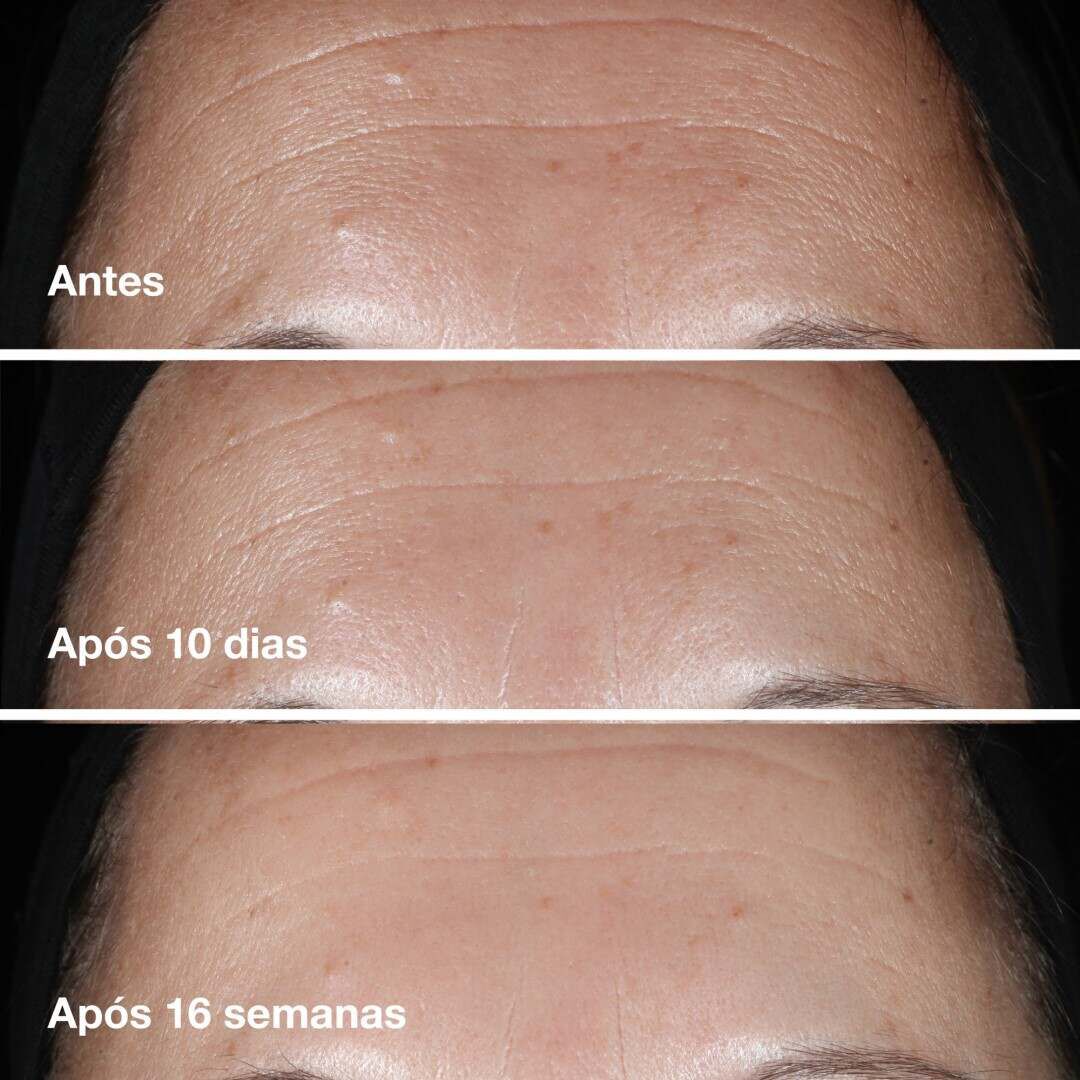 Clinique Smart Clinical Repair™ Wrinkle Correcting Serum - CLINIQUE - Smart - Imagem 10
