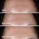 Clinique Smart Clinical Repair™ Wrinkle Correcting Serum - CLINIQUE - Smart - Imagem 10