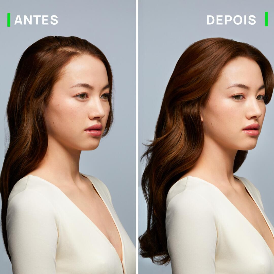 Triphasic Ampolas Queda Progressiva (8 doses) - RENE FURTERER -  - Imagem 5