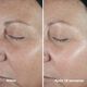 Clinique Smart Clinical Repair™ Wrinkle Correcting Serum - CLINIQUE - Smart - Imagem 8