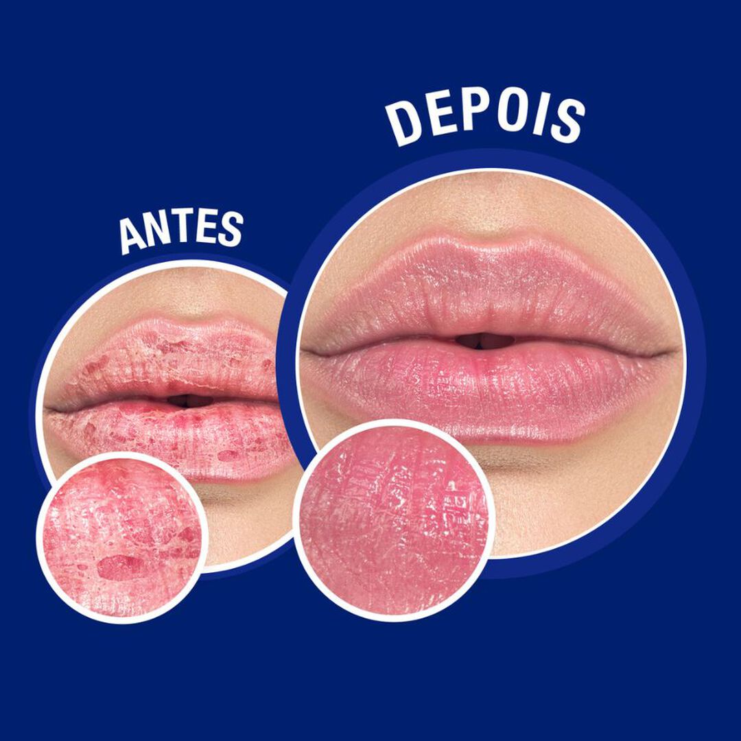 Bálsamo Reparação Imediata Nariz e Lábios - NEUTROGENA -  - Imagem 2