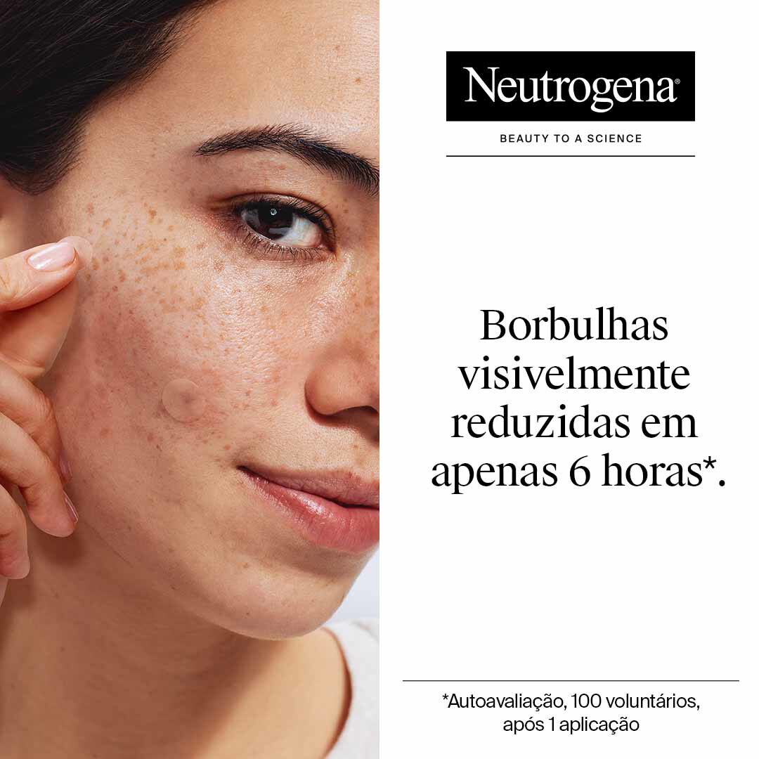 Clear & Defend+ Patches para Borbulhas para Pele Sens&iacute;vel - NEUTROGENA -  - Imagem 2