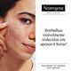 Clear & Defend+ Patches para Borbulhas para Pele Sens&iacute;vel - NEUTROGENA -  - Imagem 2