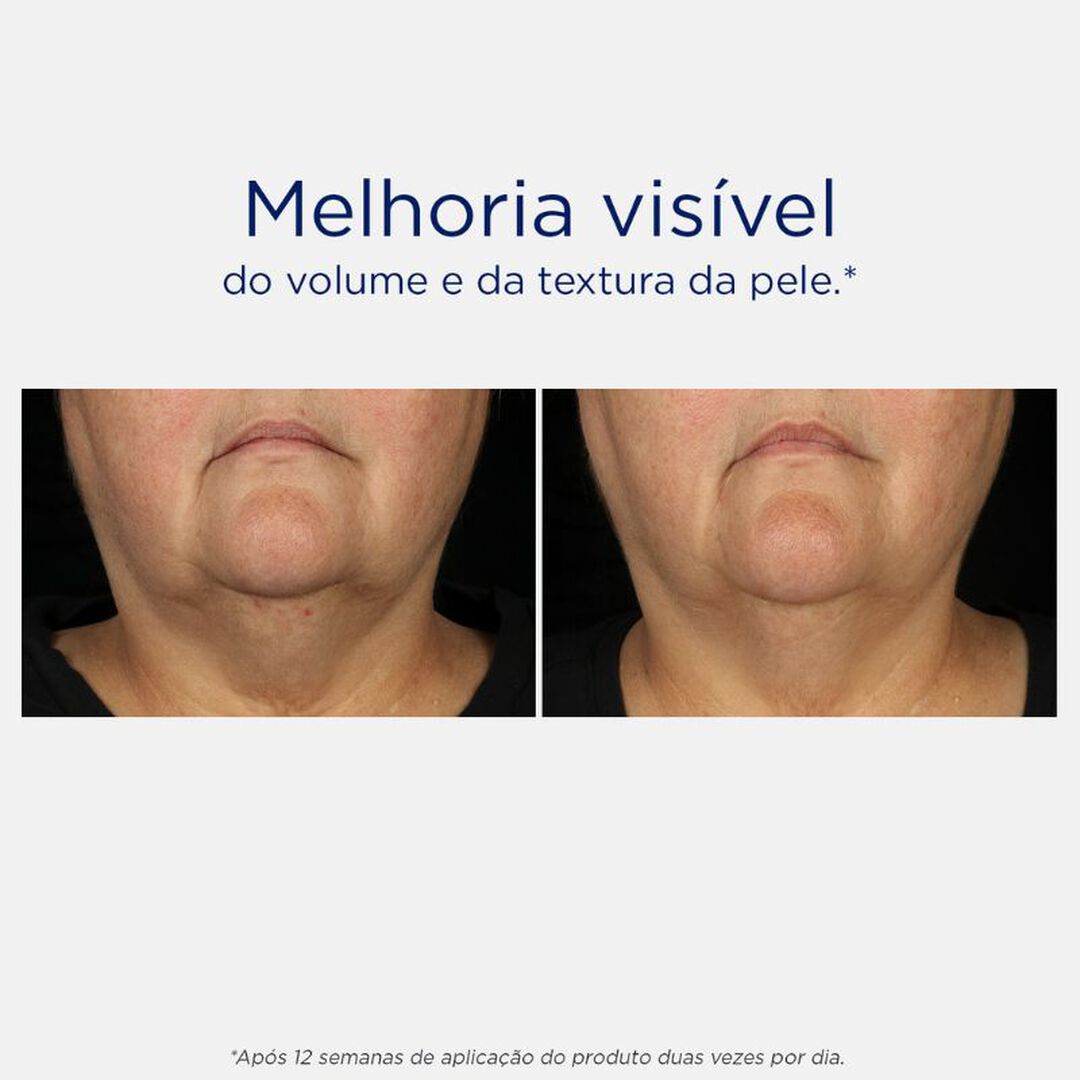 Sérum Iluminador - Skin Active Tri-Therapy Lifting - NEOSTRATA -  - Imagem 2