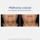 Sérum Iluminador - Skin Active Tri-Therapy Lifting - NEOSTRATA -  - Imagem 2