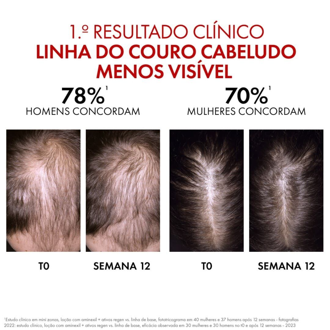Dercos Aminexil Clinical Regen Booster - DERCOS -  - Imagem 2