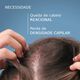 Ducray Anaphase Creastim Loção Antiqueda e Crescimento 60ml - DUCRAY -  - Imagem 4