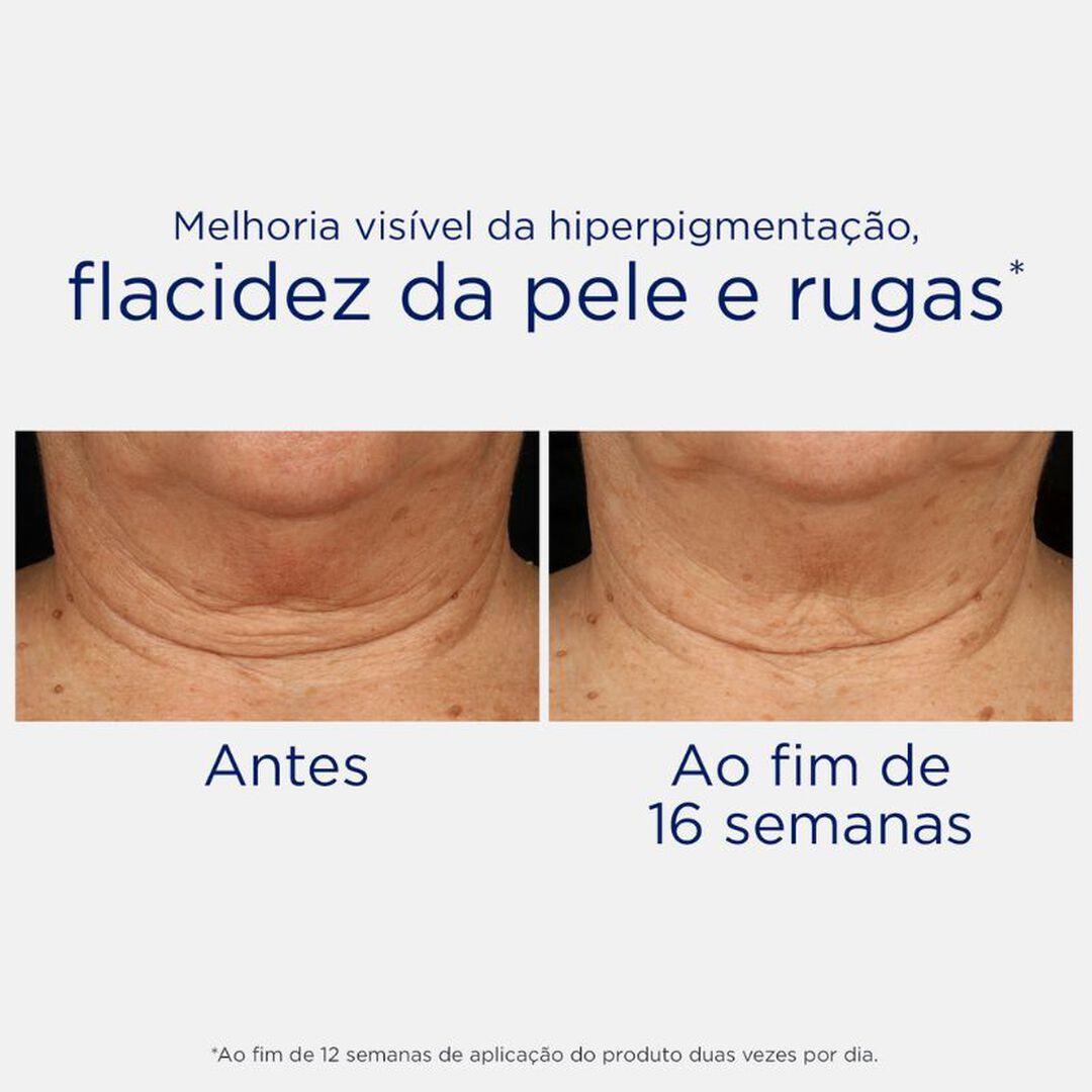 Skin Active - Creme Triplo Refirmante para o Pescoço e Decote - NEOSTRATA -  - Imagem 5