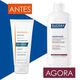 Ducray Anaphase Champô Anti-afinamento 200ML - DUCRAY -  - Imagem 3