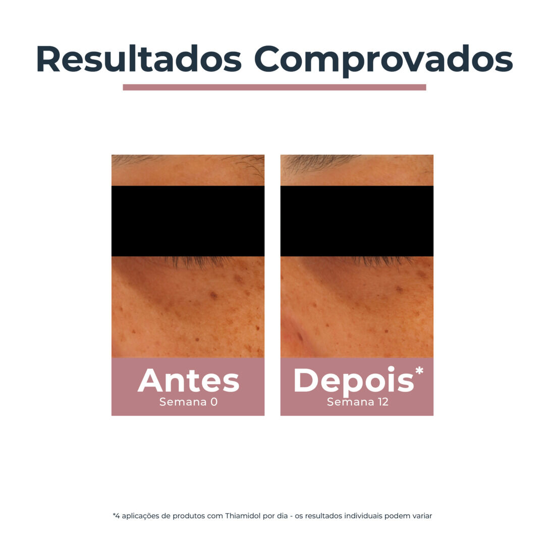 Anti-Pigment Contorno de Olhos Iluminador Antiolheiras - EUCERIN -  - Imagem 4