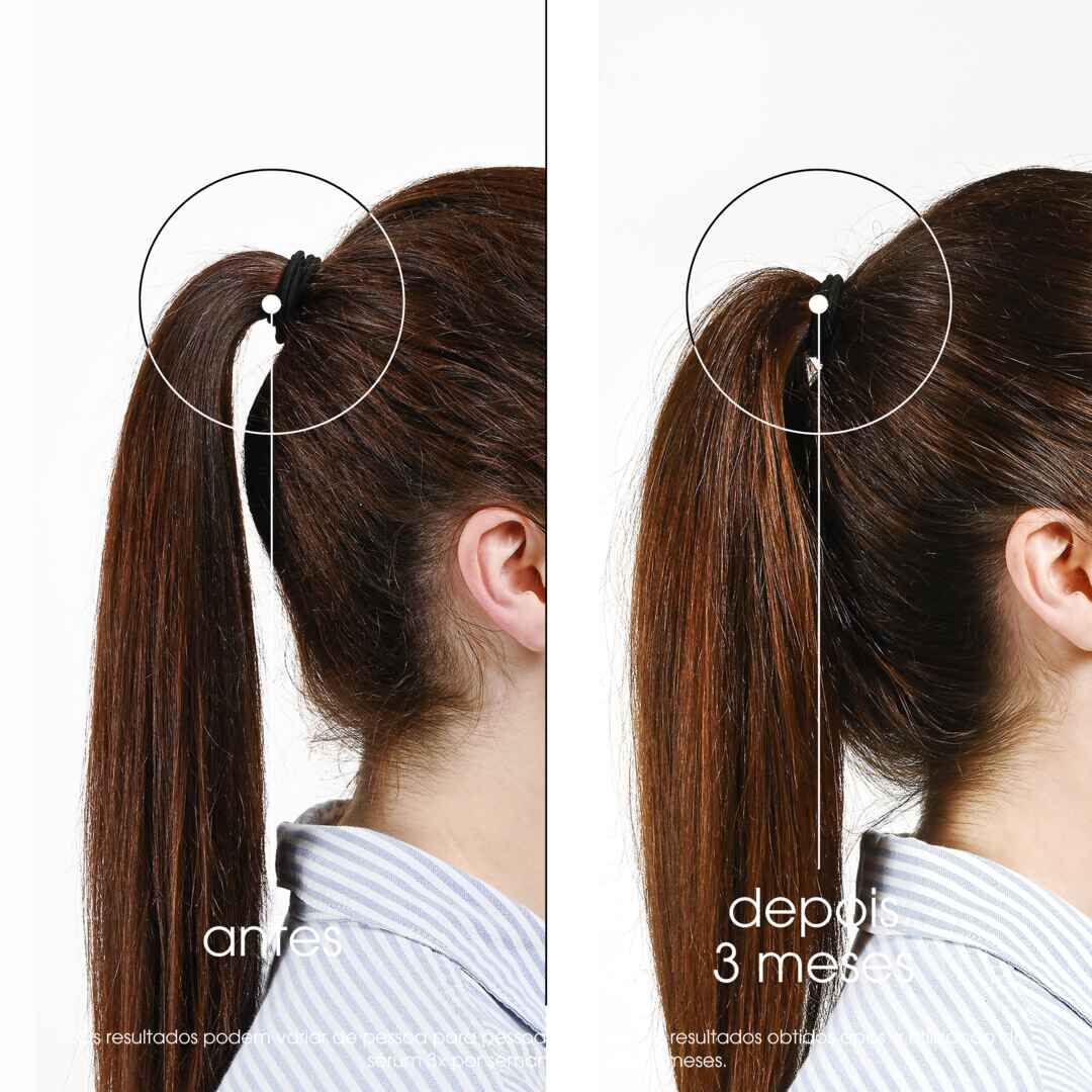 Sérum Quinina e Camu Camu - KLORANE -  - Imagem 8