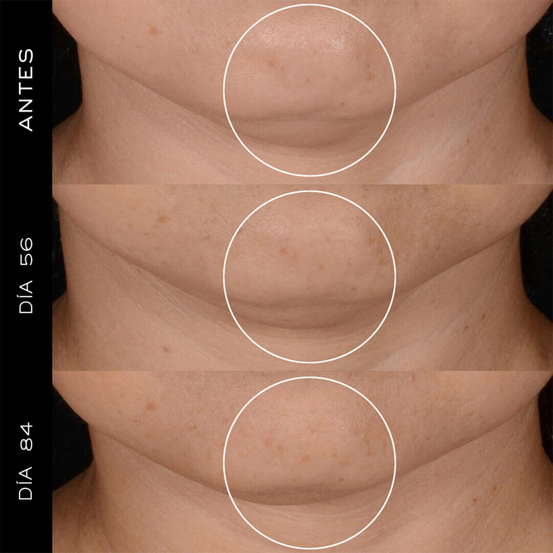 Recarga H.P.N. 300-Peptide Cream - Lancôme - Rénergie Multi-Lift Ultra - Imagem 4