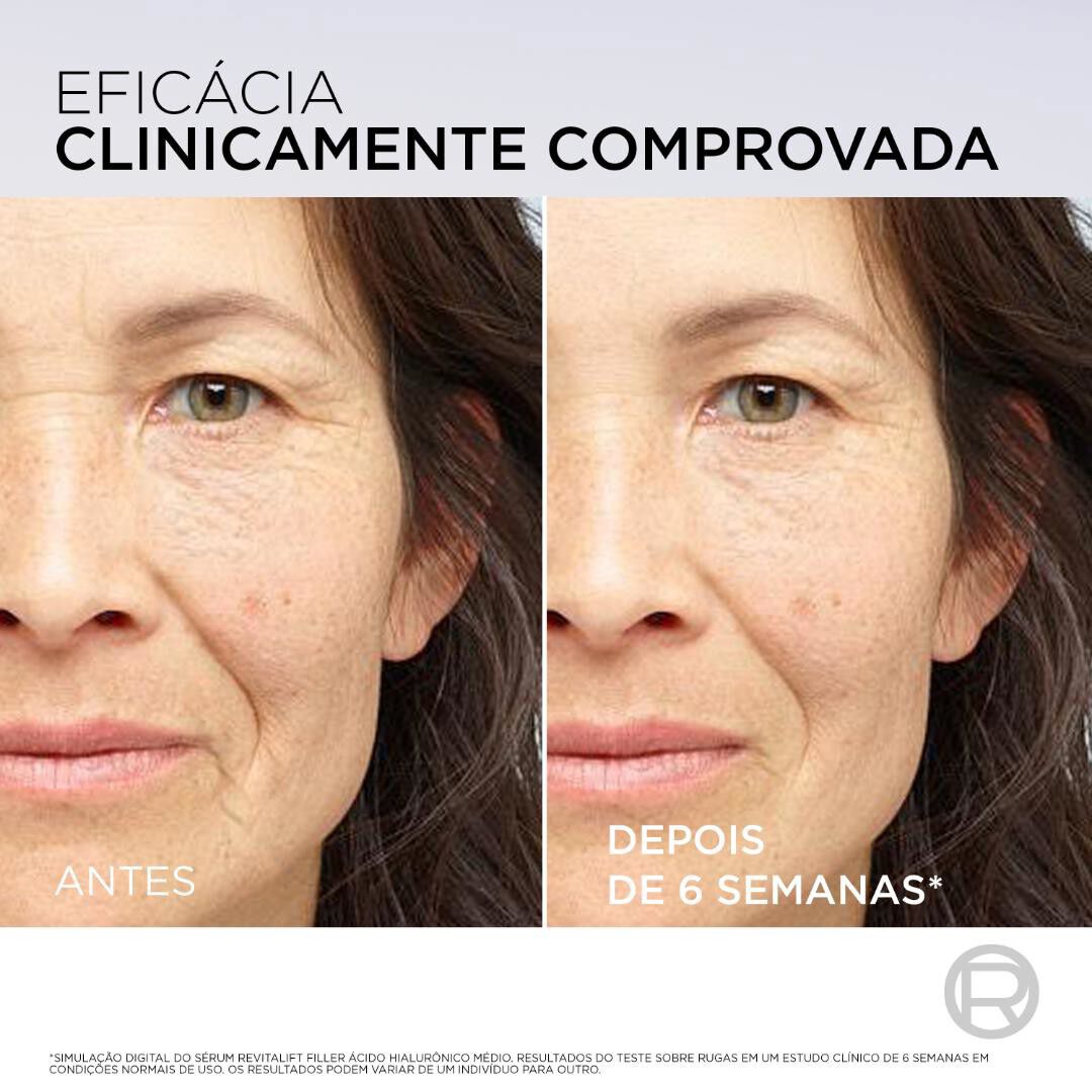Revitalift Filler S&eacute;rum - L'Or&eacute;al Paris -  - Imagem 4