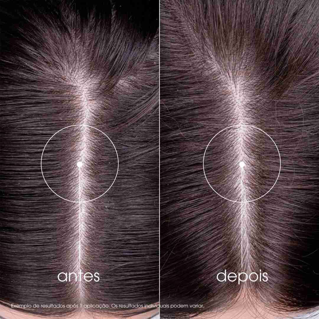 Ortiga Bio Champ&ocirc; Cabelo Oleoso - KLORANE -  - Imagem 7