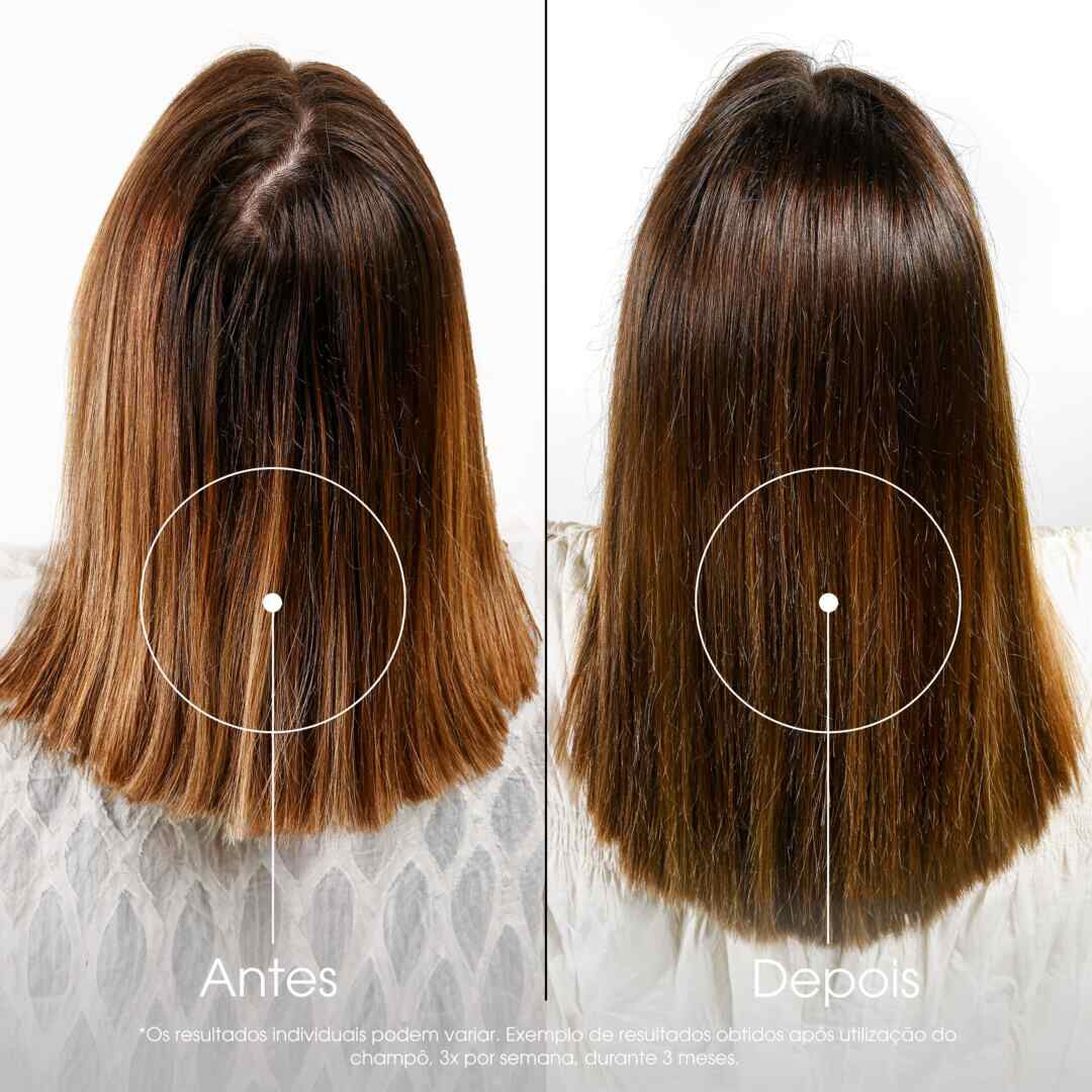 Champô Quinina - KLORANE -  - Imagem 2