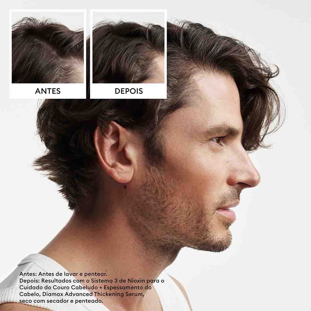 Kit Tratamento Cabelo Natural - Nioxin - Sistema 2 - Imagem 7 Kit Tratamento Cabelo Natural - Nioxin - Sistema 2 - Imagem 7