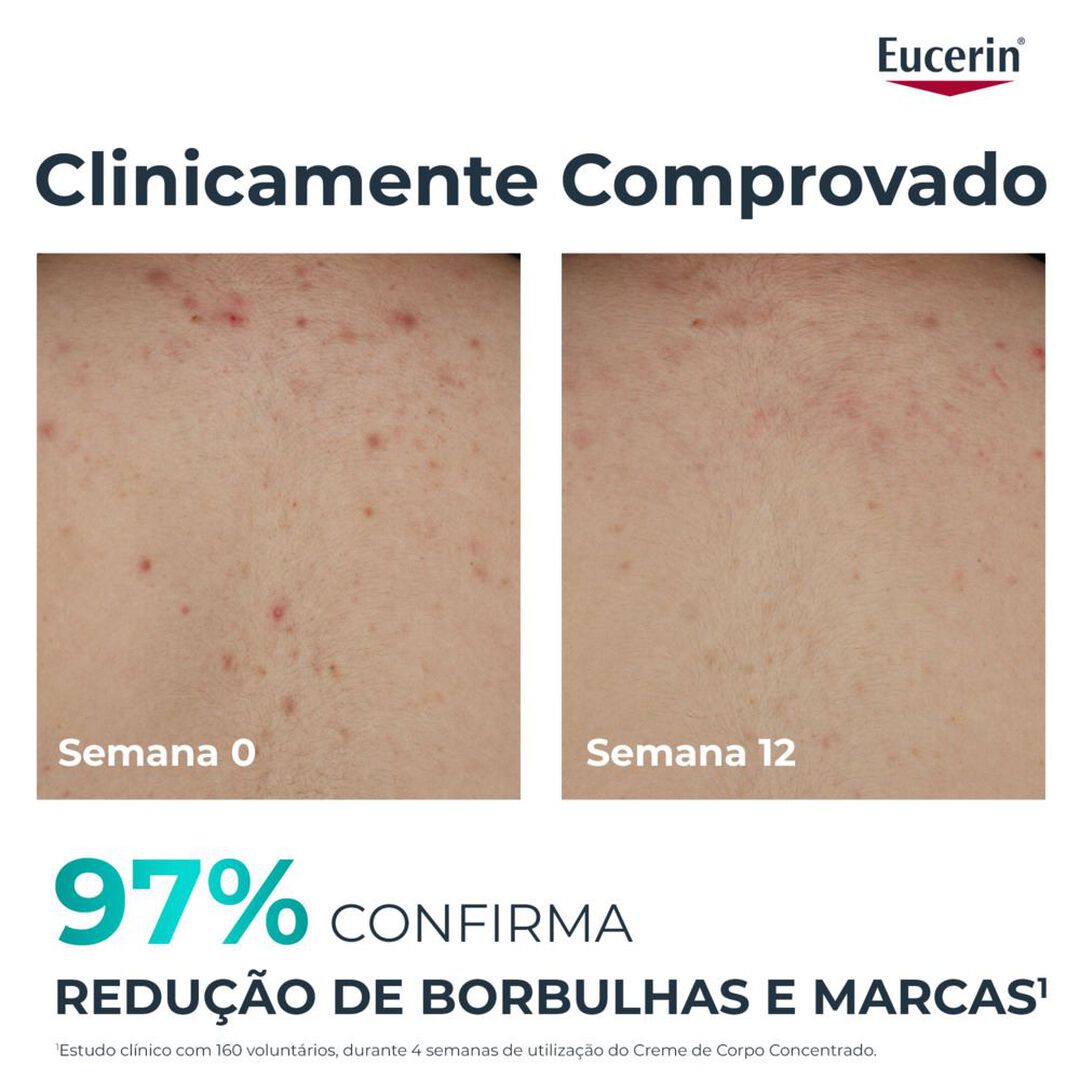 DermoPure Creme de Corpo Concentrado - EUCERIN -  - Imagem 5