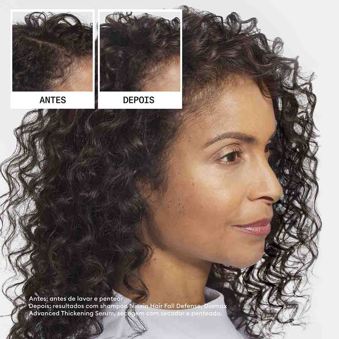 Champô Anti-Queda - Nioxin - Intensivos - Imagem 7