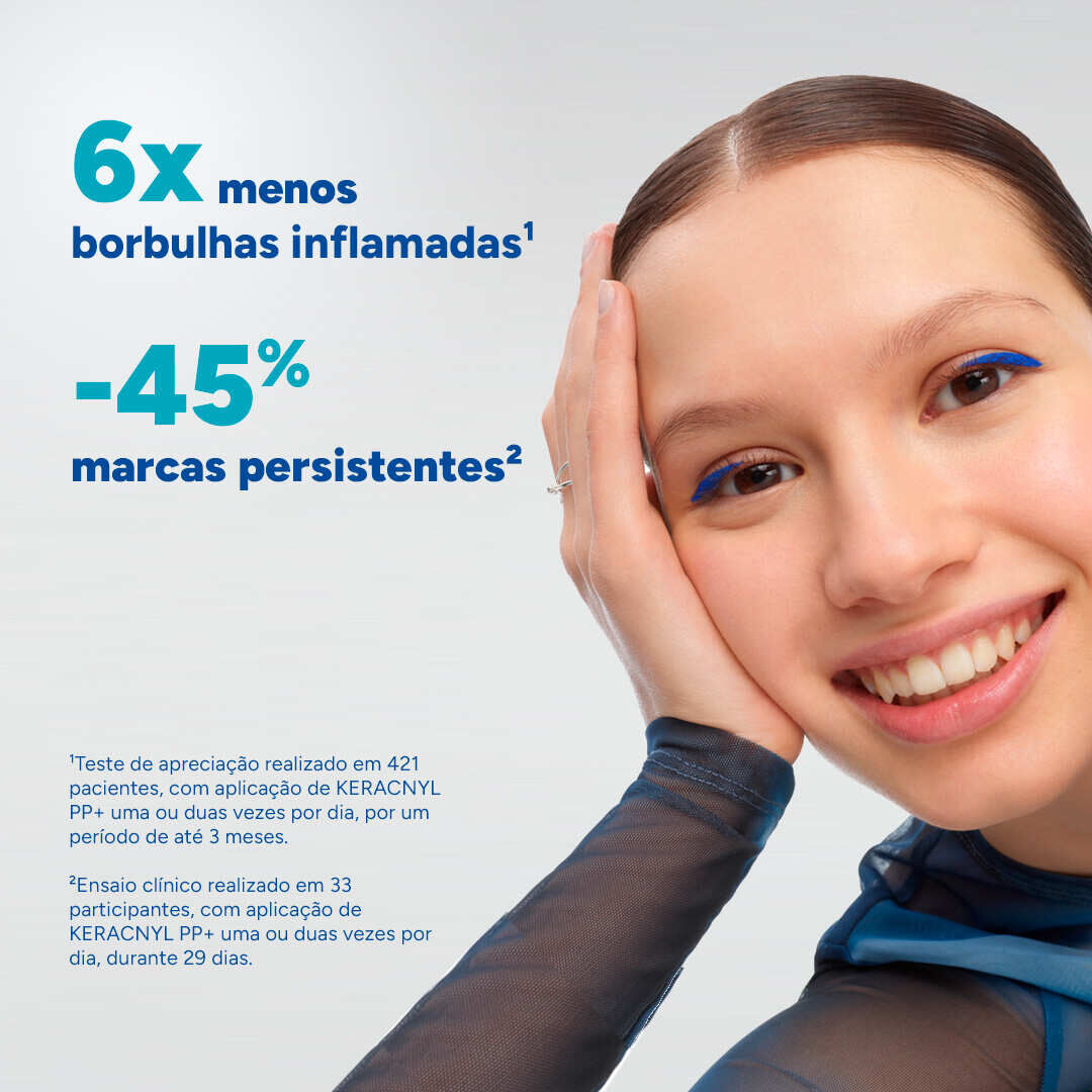 Ducray Keracnyl PP+ Creme Anti Imperfei&ccedil;&otilde;es 30ml - DUCRAY -  - Imagem 3