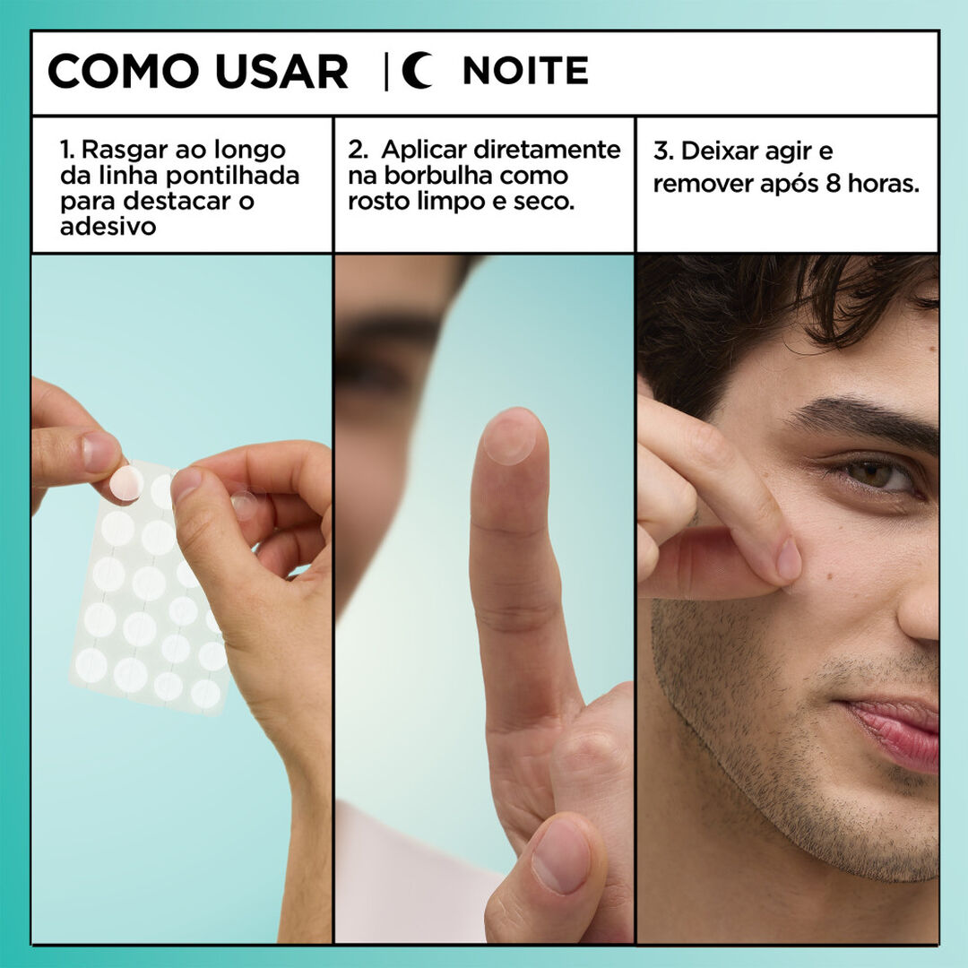 Pimple Patch Ultra Power Pure Active Anti-Imperfei&ccedil;&otilde;es. - GARNIER -  - Imagem 3
