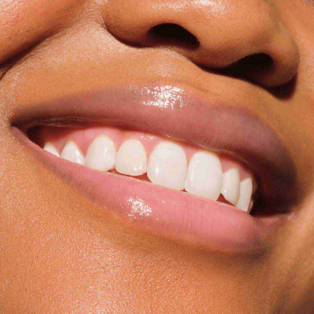 Lip Plumper - Preenchimento para lábios de fusão e preenchimento - CATRICE -  - Imagem 4