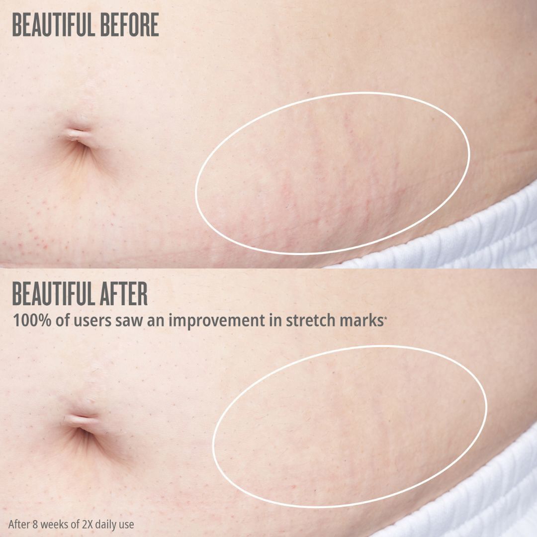 Bum Bum Body Firmeza Oil - &Oacute;leo De Corpo - Sol de Janeiro - Bum Bum - Imagem 4