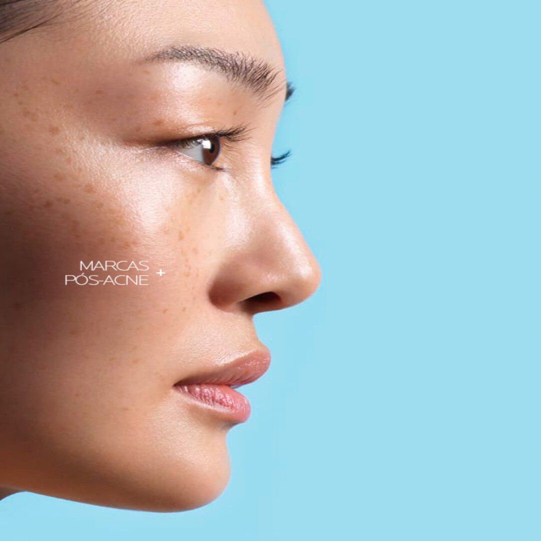 Effaclar A.Z. - Gel-Creme com Ácido Azelaico - LA ROCHE POSAY -  - Imagem 5