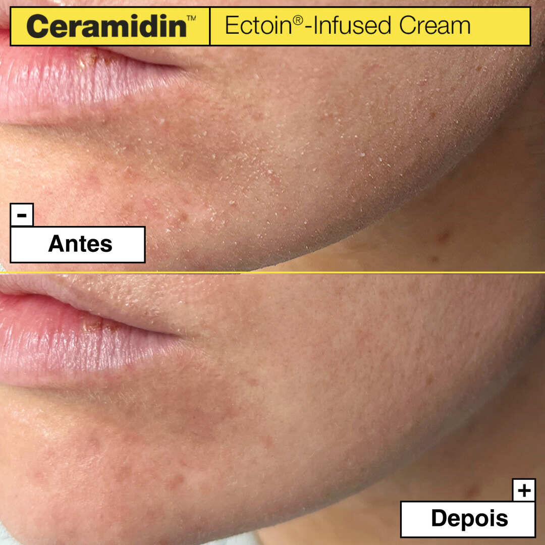 Ectoin-Infused Cream - DR JART+ - Ceramidin - Imagem 5